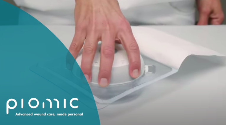 Piomic_Medical's tweet photo. Wound care has become one of the most performed services in the home care sector. 

With the COMS One® Therapy, we are supporting this shift towards more applications at home and are pleased that patients are now able to receive COMS treatment in their home environment. #medtech https://t.co/cdlhqAKTqH