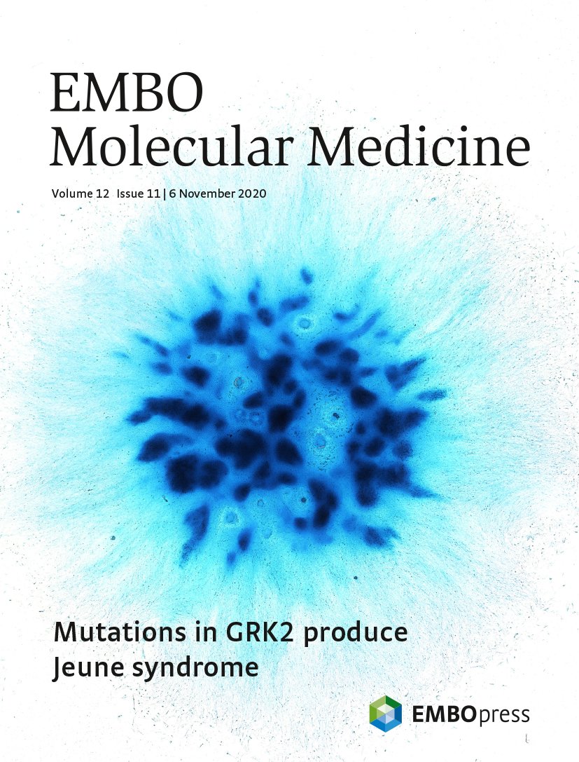 MarcelaBuchtova's tweet photo. Our #micromass culture established from #limb bud of #chicken embryos got on the cover of November issue of @EmboMolMed. You can access the paper here: https://t.co/h1PdJAGCjT https://t.co/HnpjCKvWIr