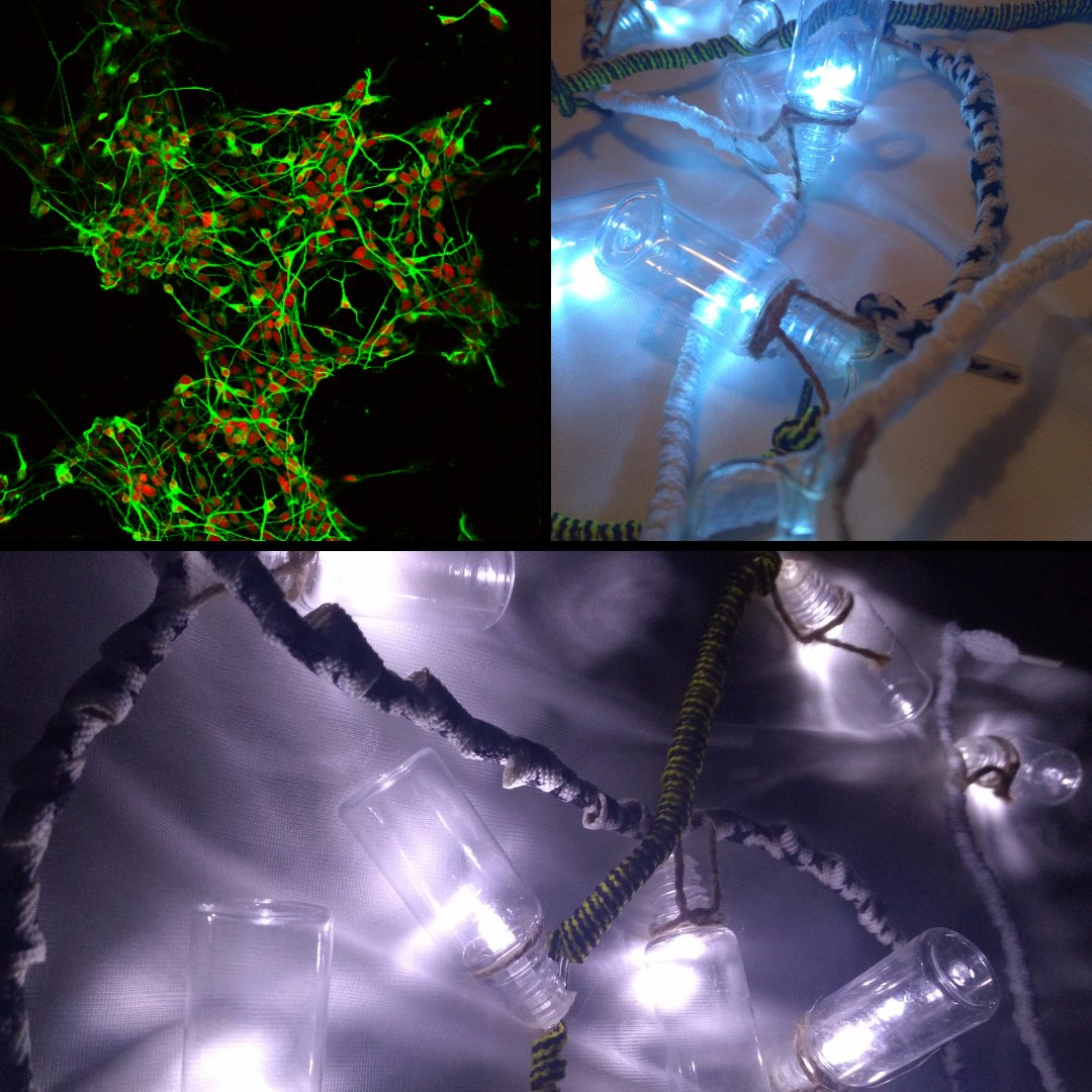 KCLstemcells's tweet photo. Sara also submitted a #RecreateScience project as part of the workshop, using fairy lights to represent electrical communications via #neurons, & laces for their myelin sheaths💡🧫❤️ https://t.co/lUYYzyH9jM