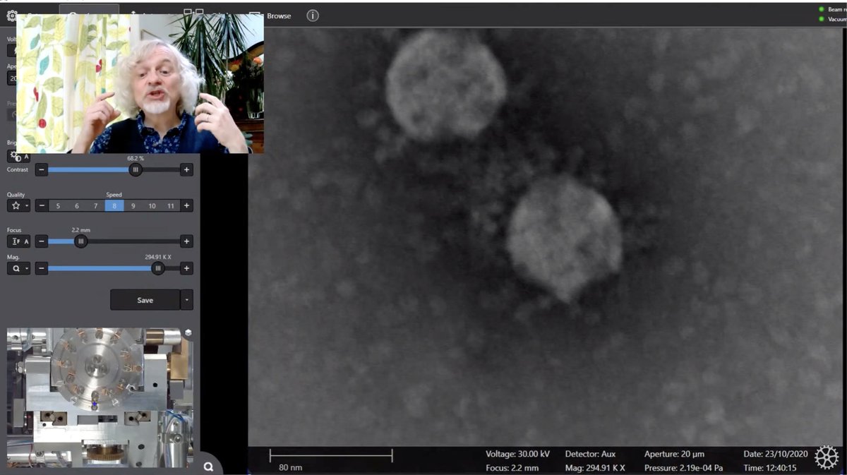 Ri_Science's tweet photo. We're all familiar with computer graphics of Coronavirus by now, but what does it actually look like?
A single SARS-CoV-2 virion is ~60 nanometres across, so @martyjopson uses a scanning electron microscope to reveal its structure in this #MicroMinute ep: https://t.co/mBGb0NHCe8 https://t.co/K0dKfXlQkq