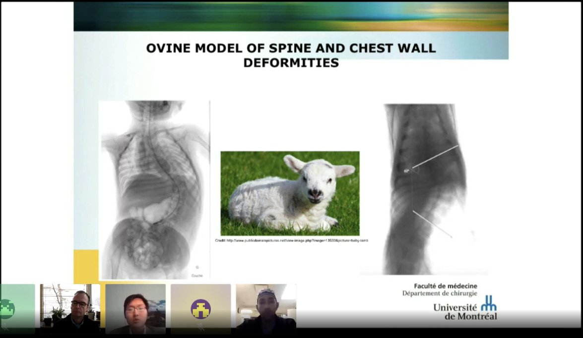 CUSEC_Surgery's tweet photo. Dr. Jesse Shen from Université de Montréal presents "Ovine Model of Congenital Chest Wall and Spine Deformity with Alterations of Respiratory Mechanics: Follow-Up from Birth to Three Months of Age"

#CCASE2020 https://t.co/4VZ4LpmPdn