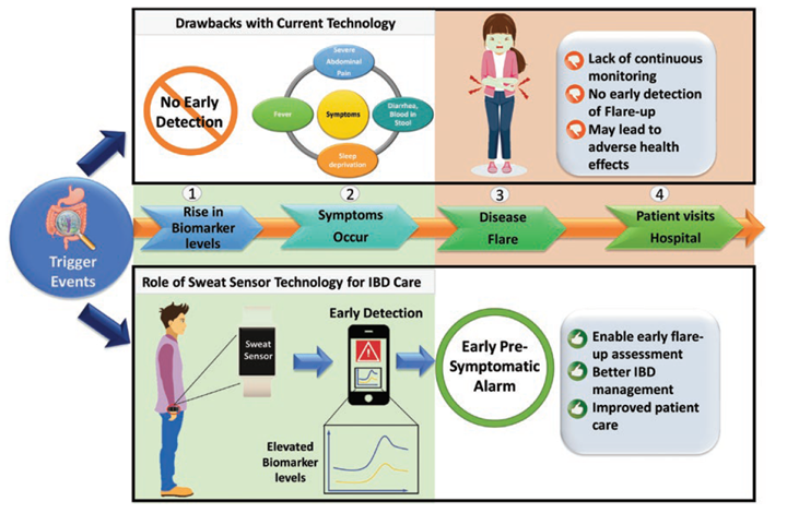IBDJournals's tweet photo. Researchers @UT_Dallas have developed sweat-based wearable technology for detecting IL-1β and CRP in #IBD. This could provide real-time flares data. Could early detection and treatment prevent full-blown flares for patients? https://t.co/GhspahrKqm https://t.co/O0Ifv4ki4q