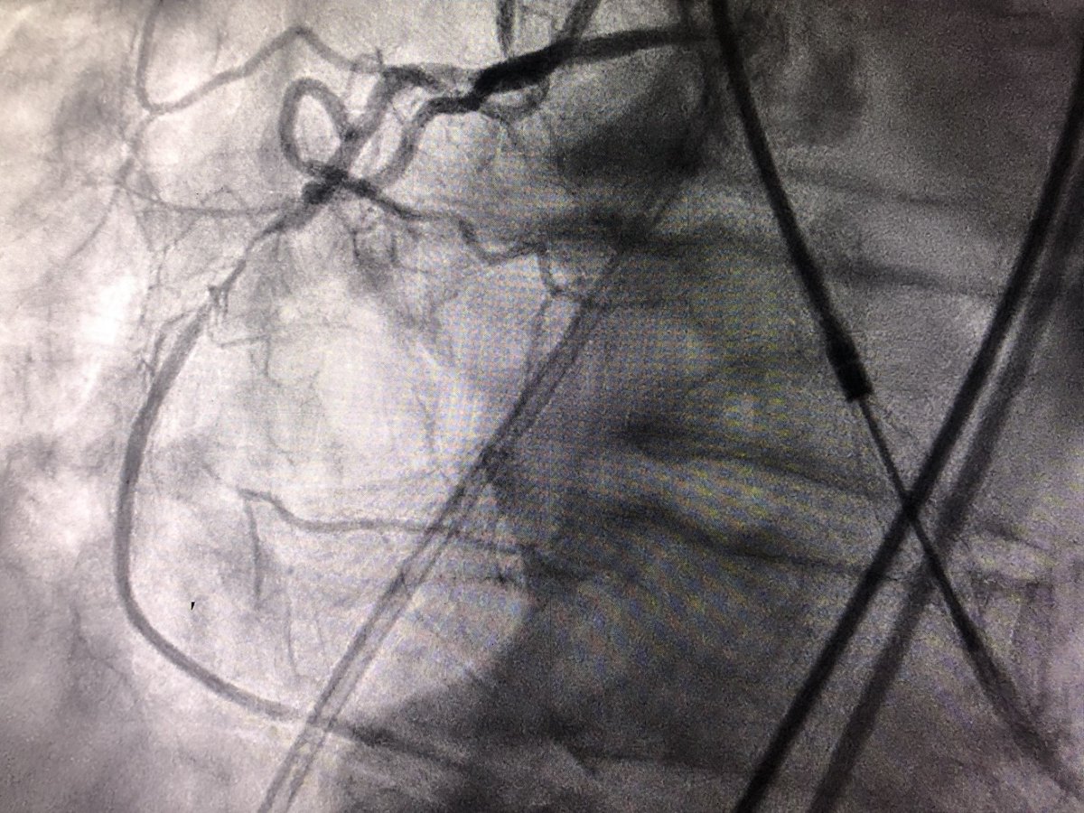 Amir Kaki, MD tweet media