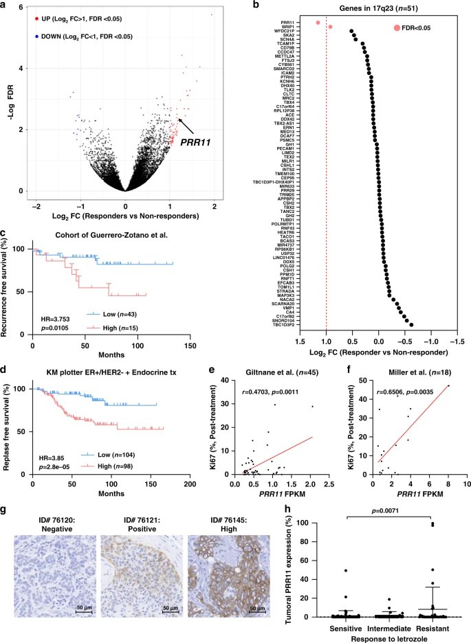 The 17q23 amplicon is associated with poor outcome in ER+ BC. Kyung-min showed that high levels of PRR11 in this amplicon were associated with poor response to antiestrogens in every. single. database, starting with  @AngelZotano's cohort of patients treated with letrozole /2