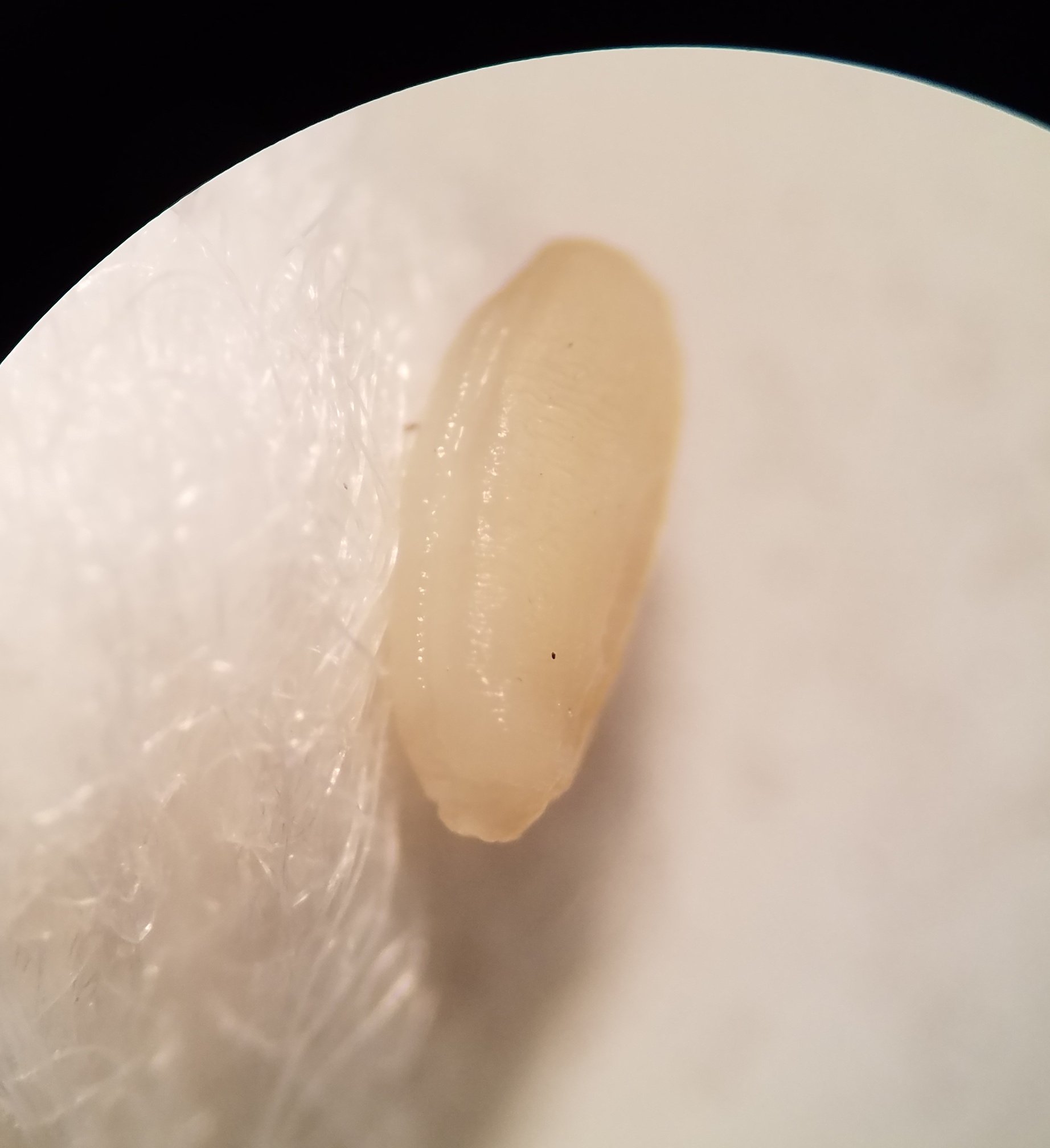 Tapeworm Segments In Human Stool