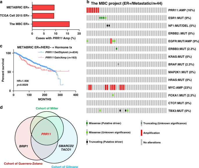 PRR11 amp is more frequent in metastatic ER+ breast cancer and mutually exclusive with other drivers of antiestrogen resistance in data from  @MBC_Project and associated with poor response to hormonal therapy in the METABRIC cohort /3