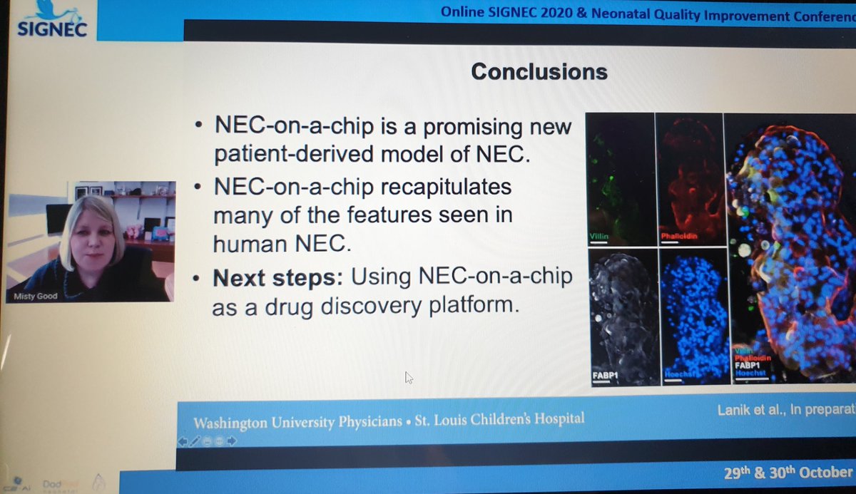 mkrettiwt's tweet photo. @mistygoodlab talking about #NEC ON A CHIP
#SIGNEC2020
@SIGNECconf https://t.co/7AXpgQowSl