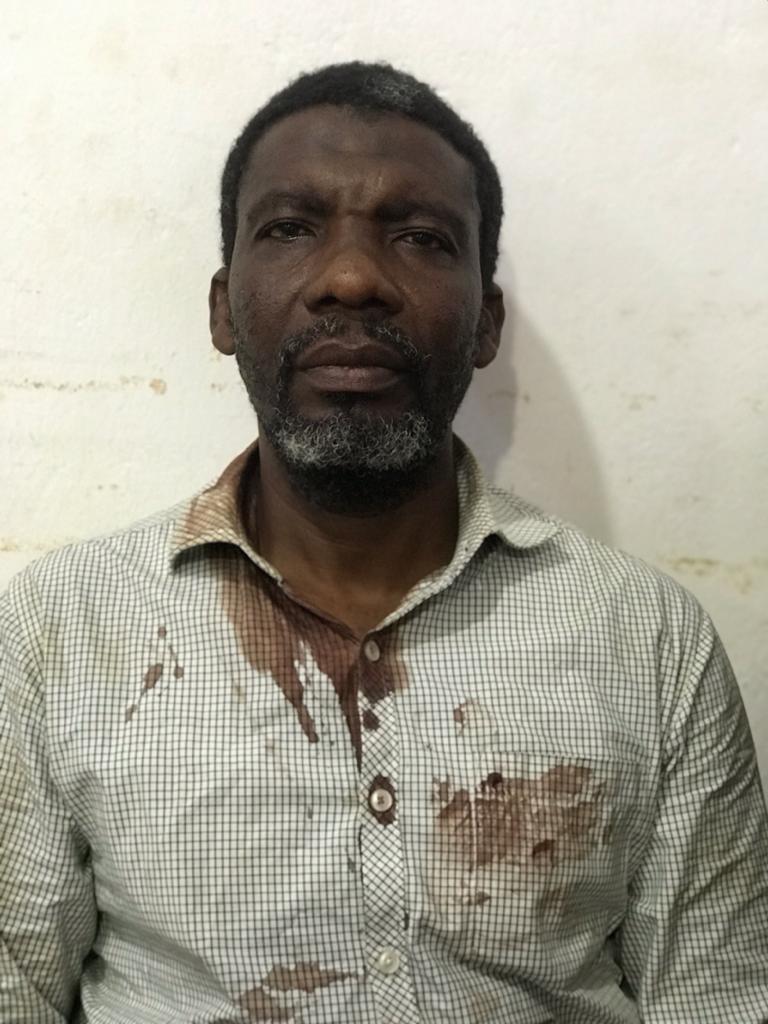 elias_mambo's tweet photo. #TanzaniaDecides2020  On election day opposition leader in Zanzibar Mohammed Nur was abducted and later released after being tortured https://t.co/xwSHKpQyad