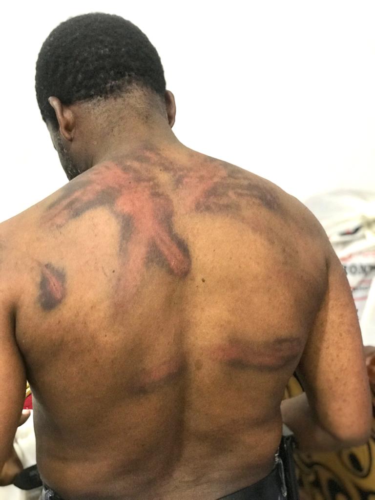 elias_mambo's tweet photo. #TanzaniaDecides2020  On election day opposition leader in Zanzibar Mohammed Nur was abducted and later released after being tortured https://t.co/xwSHKpQyad
