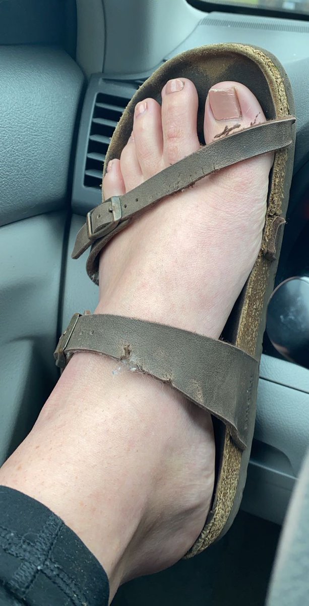 My broke down birks and toes before I gave myself a pedi.