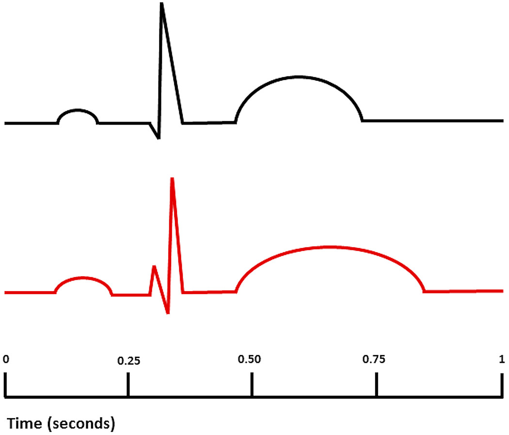#ImagesoftheWeek Proarrhythmic electrophysiological and structural remodeling in rheumatoid arthritis
https://t.co/35rZCaxnWl
@DrFuSiongNg @DrKiranPatel1
#OpenAccess article!
#RheumatoidArthritis #SuddenCardiacDeath #VentricularAarrhythmia #immunology #electrophysiology https://t.co/tG6xsiPWi4