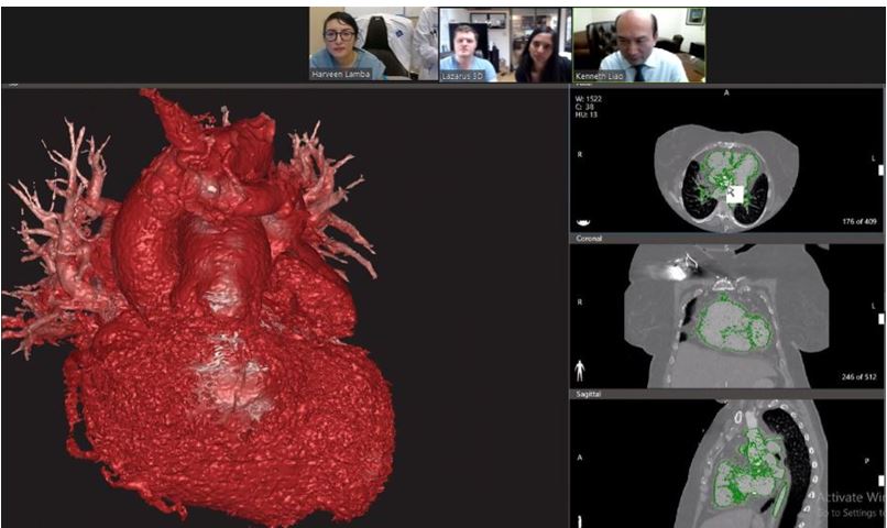 DrHLamba's tweet photo. Industry and medicine collaborating to develop a 3D heart model for a complex congenital heart disorder. Great teaching tool for preoperative planning. @BCM_Surgery @DrKenLiao @Lazarus_3D #3Dprinting @GloorLoor https://t.co/t7v0iu4eAG