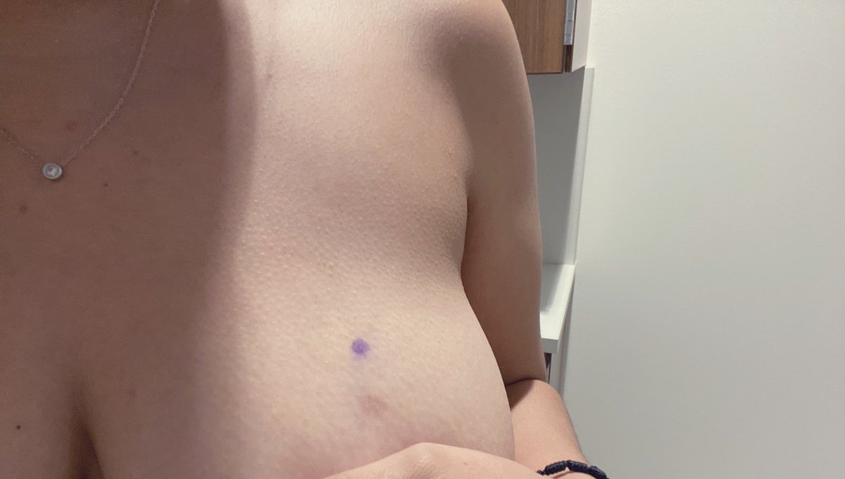 ramirez_karla97's tweet photo. Girls Get Your Titties Checked!!!! A small lump can mean so many things 💕 #BreastCancerAwareness #checkyourtits https://t.co/jlYSR0YXmy