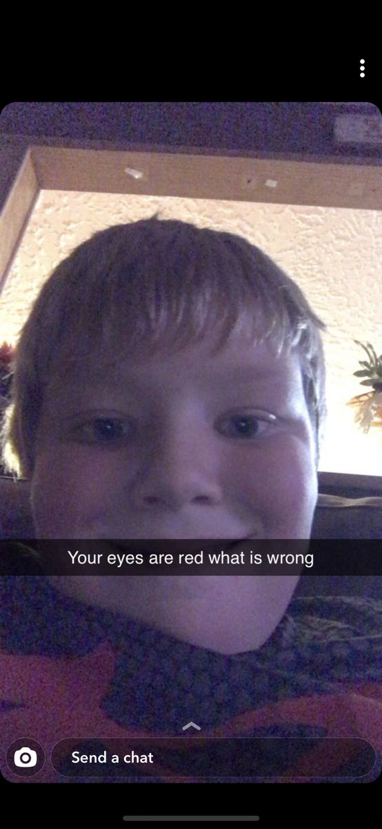 destwitch's tweet photo. My eyes get crazy bloodshot when I drink, and I’ve had a few tonight. Well, it must look pretty bad cause I snapped Brody and Jaelin and this was their responses 😂😂 https://t.co/1N5g5apiRj