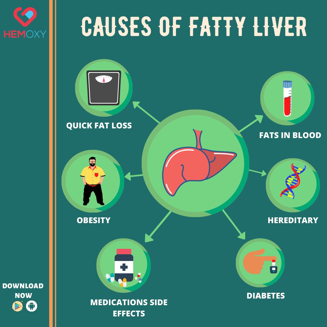 Hemoxy1's tweet photo. Having a fatty liver ? These are the causes of that, Book your diagnostic test online now. 

Get a free home sample collection
.
.
.
.

 #hemoxy_official #hemoxy #fattyliver #liver #onlinebloodsamplecollection  #laboratorynearby  #homecollection #healthcare #COVID19 #pathologylab https://t.co/4RPMETqJfo