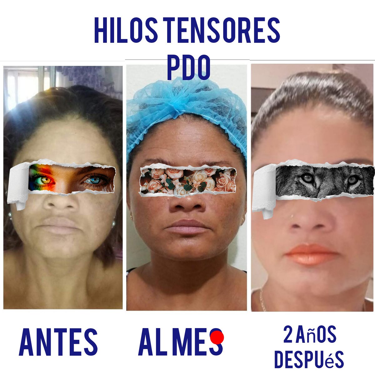 StembioCellaa's tweet image. Hilos tensores PDO.