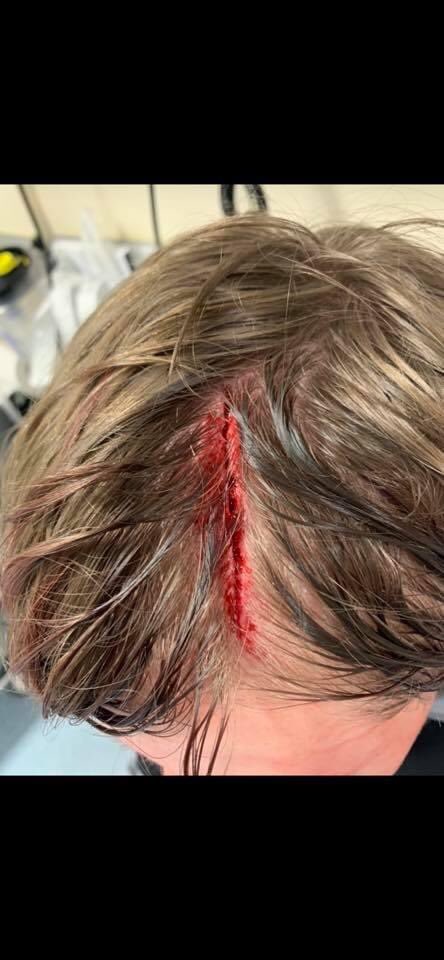 raffertymartin1's tweet photo. A mother talks about her brave son who was viciously attacked weeks before #NoahDonohoe went missing. #SameArea #SameTime #ThisCantHappenAgain       #RememberMyNoah💙 #NoahsArmy⚡️                        https://t.co/DYEY7C2yM8 https://t.co/kqWl1jfVgU