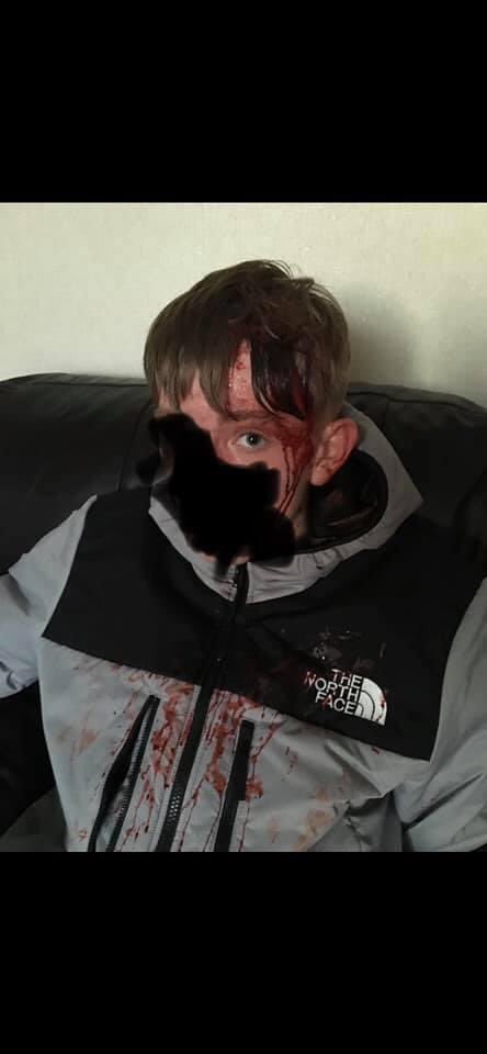 raffertymartin1's tweet photo. A mother talks about her brave son who was viciously attacked weeks before #NoahDonohoe went missing. #SameArea #SameTime #ThisCantHappenAgain       #RememberMyNoah💙 #NoahsArmy⚡️                        https://t.co/DYEY7C2yM8 https://t.co/kqWl1jfVgU