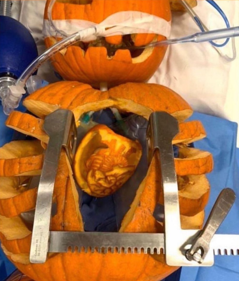 CardioSurgPost's tweet photo. It is Halloween already! 🎃😂 #cardiosurgerypost #cardiotwitter #medtwitter #Halloween #HappyHalloween https://t.co/qvD82avEy7