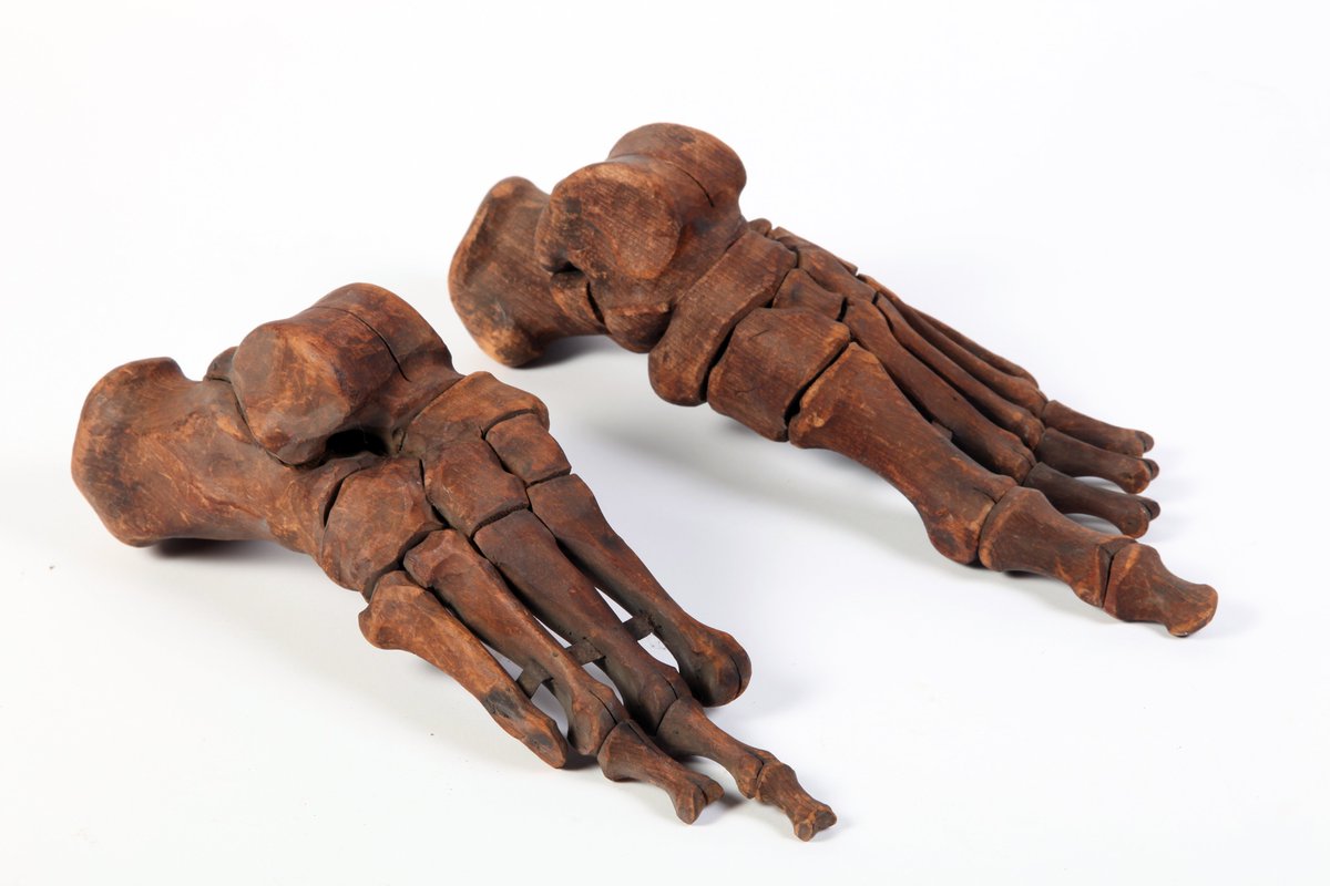 Now for one of the creepier parts of the collection...These fragments of a female skeleton were carved in wood c.1819 by sculptor John Hogan, aged just 19. They were commissioned by Dr John Woodroffe as a teaching tool for use in his School of Anatomy. No grave robbing here! 