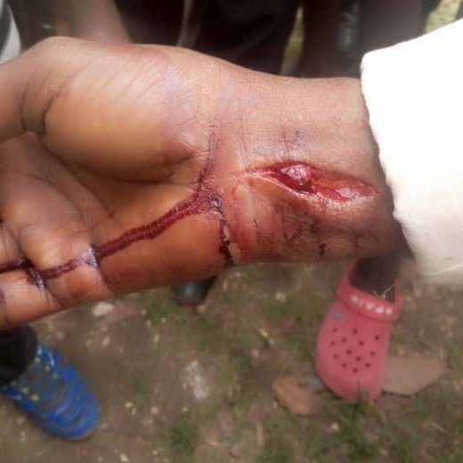 BurundiSda's tweet photo. There is no Happy Sabbath in #Burundi where @ECDAdventist is shedding blood of women and children; yet you are silently supporting this bloody leadership. Pathetic!! @pastorruguri @adventistnews @spectrummag @AdventistToday @NADadventist @EUDDivision @SidSocial @SouthernNews https://t.co/ClvBcHEXsY