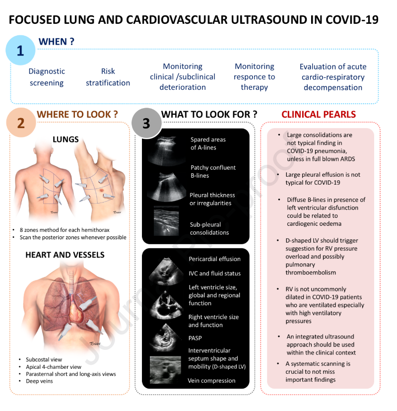 NephroP's tweet photo. #POCUS in #COVID19 infographic
From: https://t.co/i3RGGvXLKe https://t.co/PN2JZpN7x0