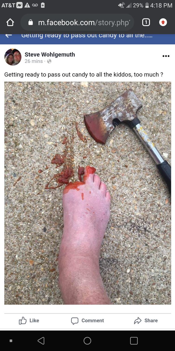 11clay20's tweet photo. My dad is never chilling I swear. 🤦 having a toe amputated was a dream come true for him https://t.co/jrqnXHaZ0q