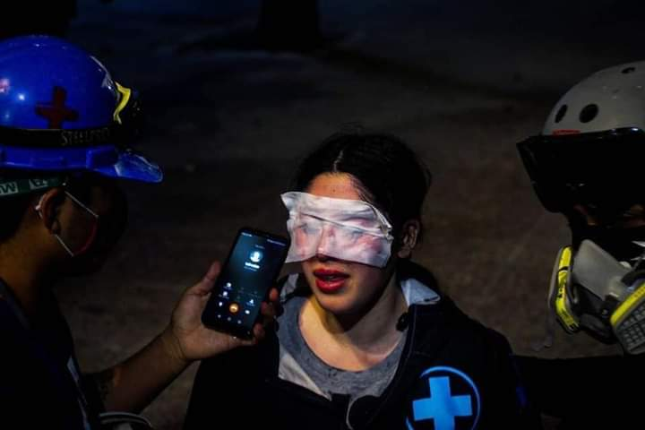 capucha_informa's tweet photo. #PacosAsesinos │ Tatiana, brigadista de salud fue brutalmente atacada el 23 de octubre por funcionarios de carabineros con gas pimienta y asegura hasta hoy no poder ver porque tiene sus corneas quemadas. https://t.co/PrrqePwV3I