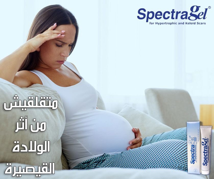 SpectragelEgypt's tweet photo. كل الأمهات بتكون قلقانة من أثر الولادة القيصرية وإن الأثر ده مش بيروح بسهولة وأحياناً بيفضل أثرها دايماً موجود، بس مع سبكتراجل إحنا بنضمنلك علاج الأثر والوقاية من تكون أى ندبة مكان الولادة.

#سبكتراجل_هو_الحل
#Spectragel https://t.co/G0EKFko777