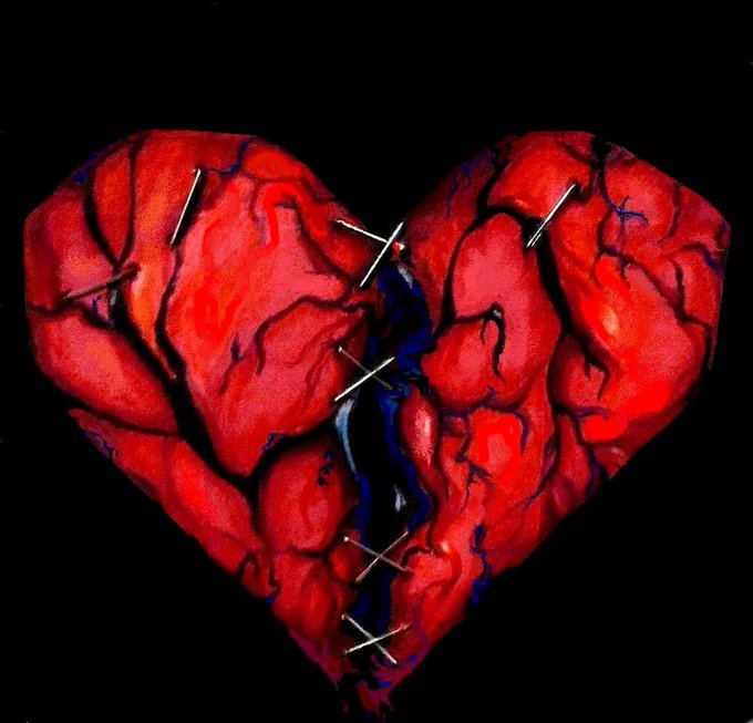 I feel... Heartbroken. Pain. Fear. Lonely. Helpless. Isolated. Devastated. I feel completely worthless<a href="/tag/mvsales"class="tags"><span>#mvsales</span></a>