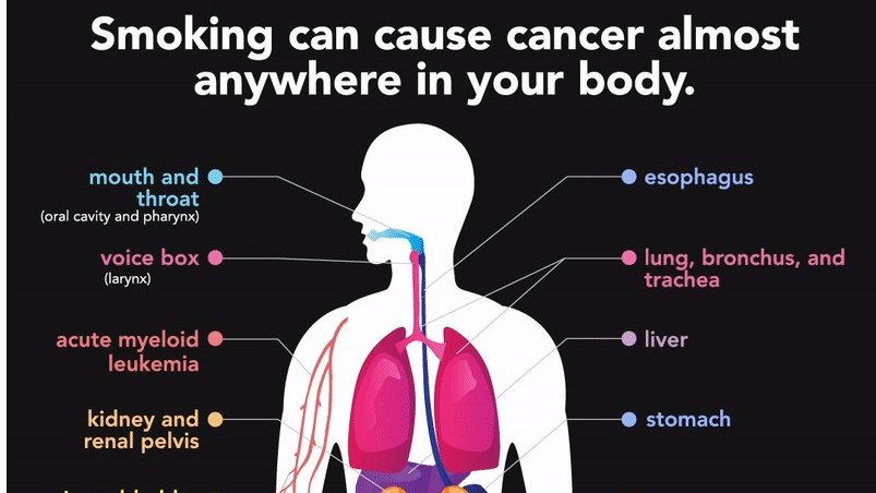 LCDHD's tweet photo. Week 45 of the 52 Weeks to Health: Smoking
Cigarette smoking is the leading preventable cause of death in the United States. There are more than 480,000 deaths each year in the United States caused by cigarettes.
https://t.co/eBjycJ0lao
#lcdhd https://t.co/AxPexT8sc2