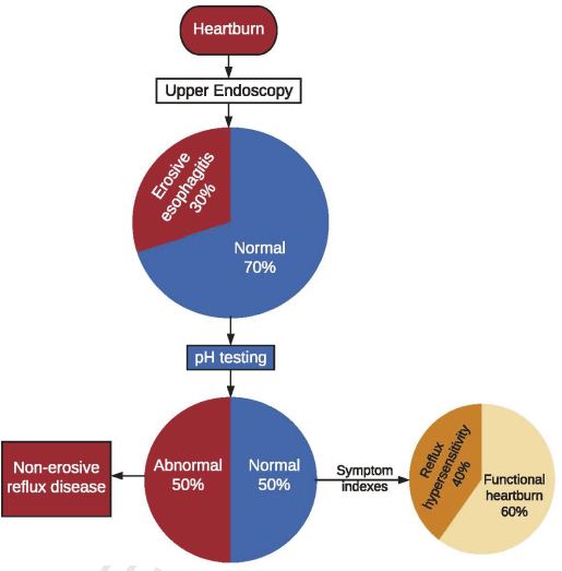 2/ GERD is common and is the #1 GI diagnosis in the United states!--It is also the #1 diagnosis seen by GI provider--We all know that heartburn is a common symptom (either you or someone you know had it last week)--Up to 70% of patients with HB have normal EGD, now what?