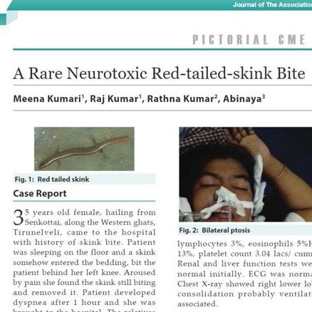 Bullshit alert!! This is how misinformation spreads. Skinks are harmless, non-venomous lizards. Why should poor skinks take the blame for a krait bite?
japi.org/x264b464/a-rar…