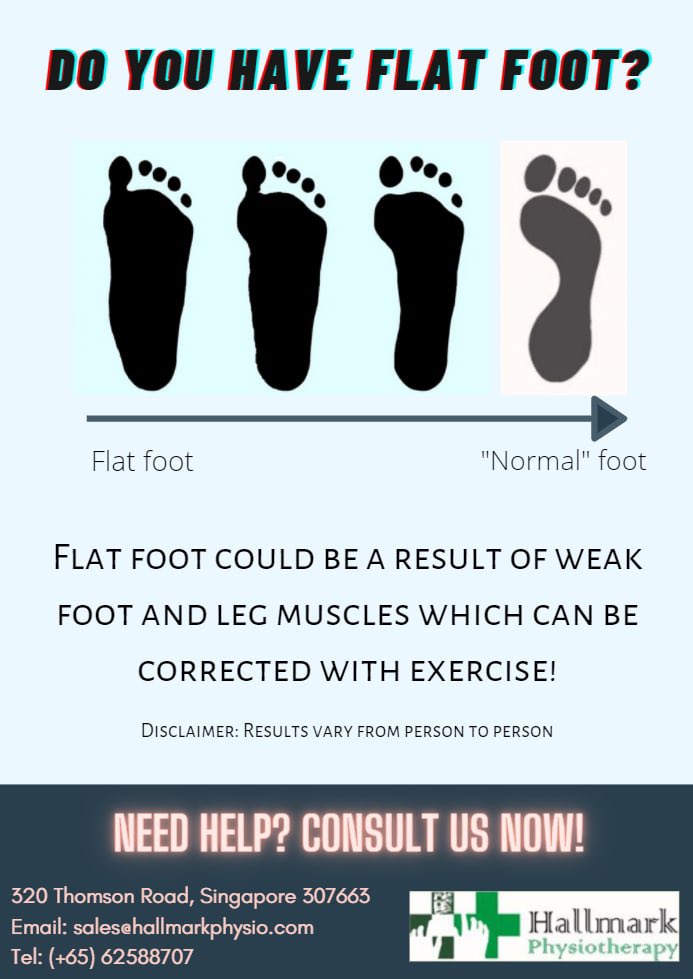 HallmarkPhysio's tweet image. Do you have flat foot? Need help correcting them? Come and consult us!