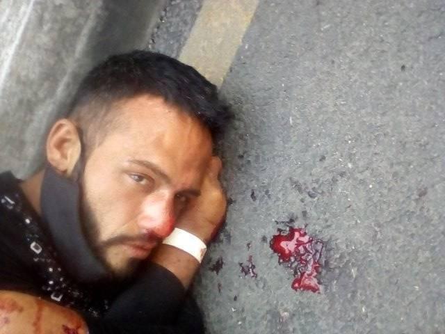 Este joven es venezolano está en situación de calle  es de Caracas   se llama  Elvis Emmanuel Luci Domas,para que los familiares lo reconozcan si hay alguien que lo reconozcan favor  llamar al 3204784612. Se encuentra en Medellin, Colombia.