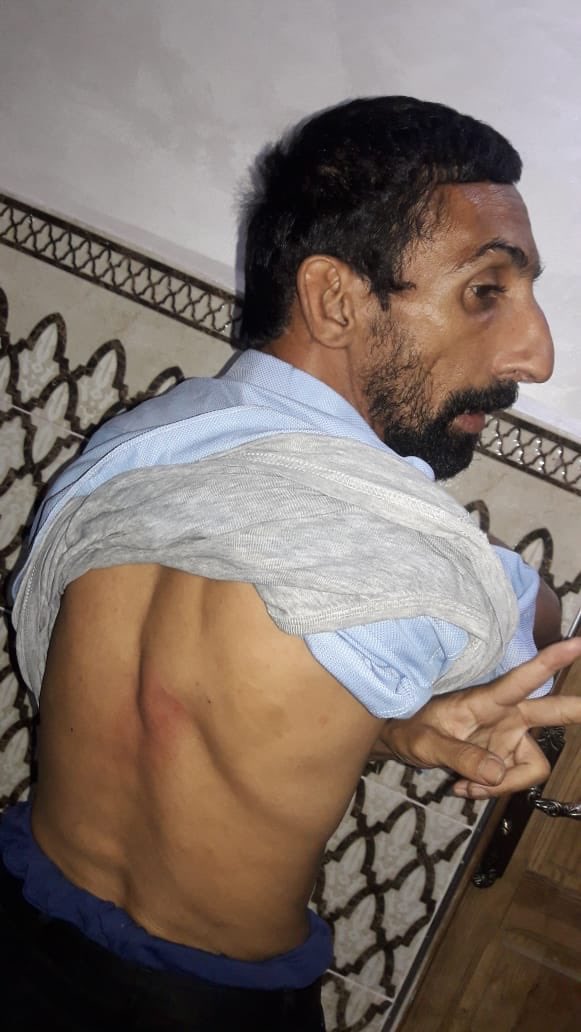 HassannaAalia's tweet photo. Las autoridades de la ocupación marroquí, han agredido con palos a Said Hadad, un activista saharaui con necesidades especiales. El ataque ha sido en El Aaiún ocupado. La policía marroquí sigue entrando ilegalmente a casas de saharauis,buscando a jóvenes.#SaharaOccidental #sahara https://t.co/pr3yDcFs5r