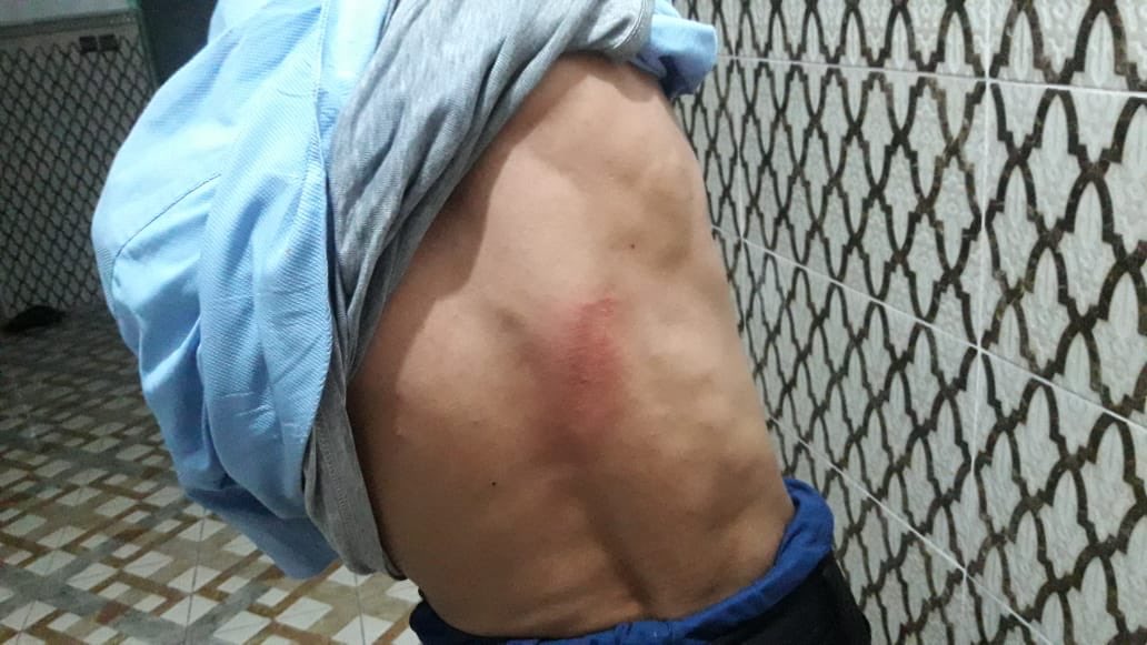 HassannaAalia's tweet photo. Las autoridades de la ocupación marroquí, han agredido con palos a Said Hadad, un activista saharaui con necesidades especiales. El ataque ha sido en El Aaiún ocupado. La policía marroquí sigue entrando ilegalmente a casas de saharauis,buscando a jóvenes.#SaharaOccidental #sahara https://t.co/pr3yDcFs5r