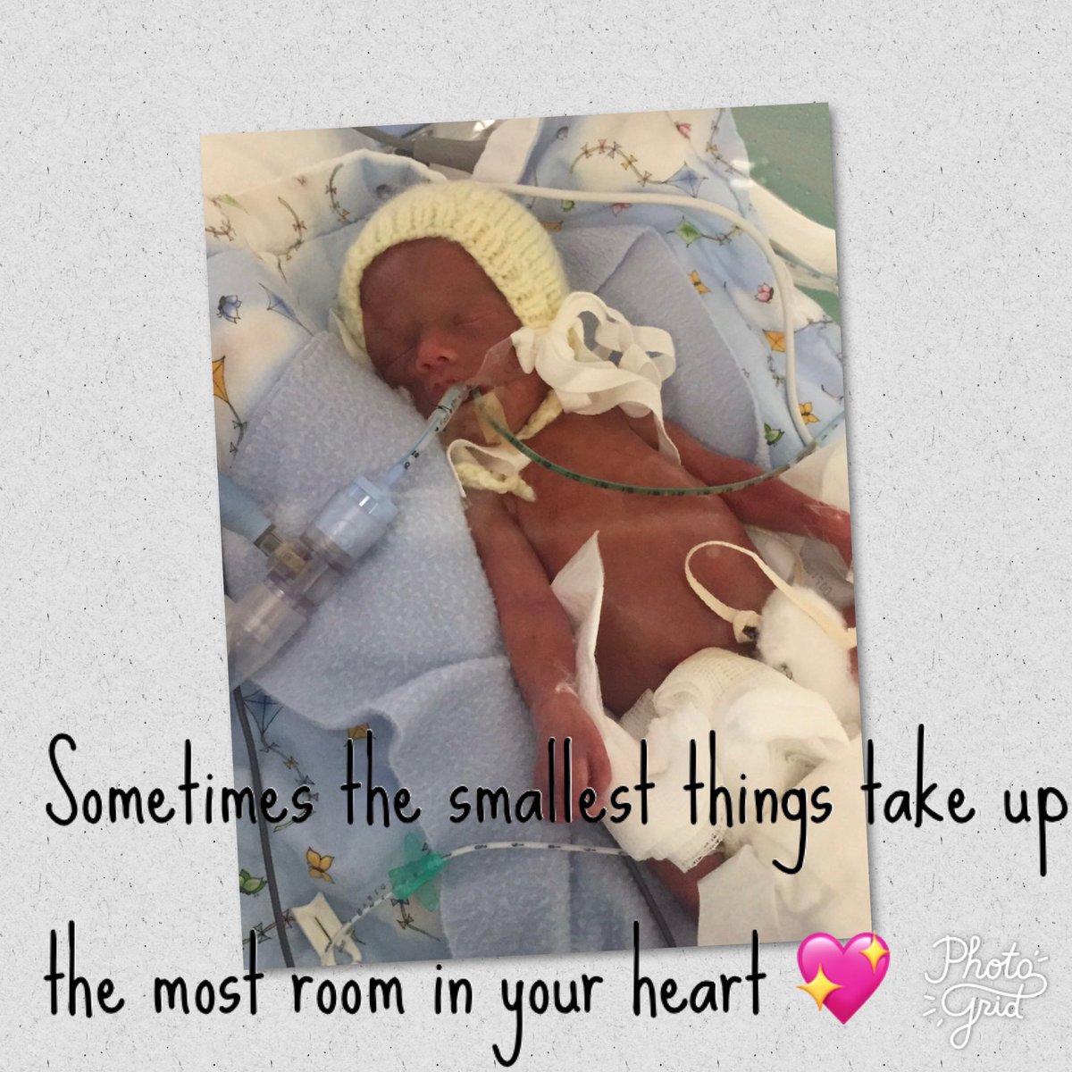 toni29317455's tweet photo. November 17th world prematurity day! Here’s to celebrating all prem babies, those that made it through the storm, those who gained there wings 👼🏼#prematurityawarenessmonth #november17 #25weeker  #miracle #nec @SSCBcharity @Blisscharity @NECUK_Charity @edinsickkids @EdinburghNeo https://t.co/NxJu39PjXo
