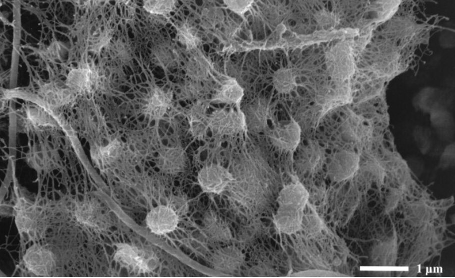 altiarchaeum's tweet photo. @archaearama @chmoei Someone shouldn‘t forget that I was discovered by the group around Robert Huber, and that wasn‘t in that spring but in a swamp!
check out the original paper and the first published image of Altiarchaea:
https://t.co/EORNoNZDTp https://t.co/Bru0cwFEcE
