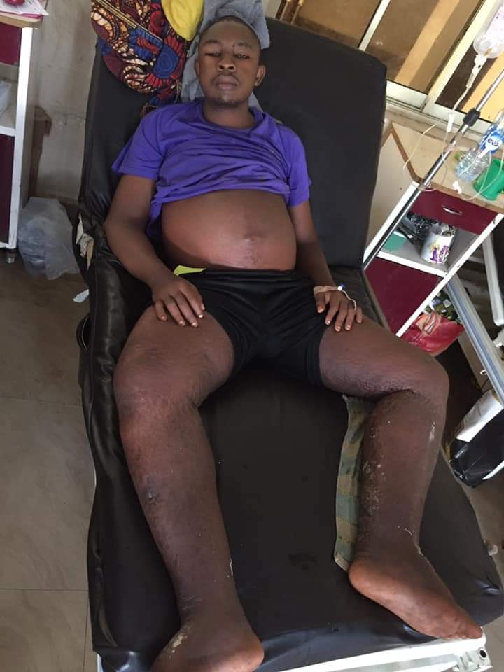 eandf_media's tweet photo. Good evening Sir/Ma. Am sorry for disturbing you this evening with this. This is a picture of Kalu Chris Johnson. He is from Ohafia, Abia State. The only surviving child of his Parent https://t.co/S2z1VdLWwa