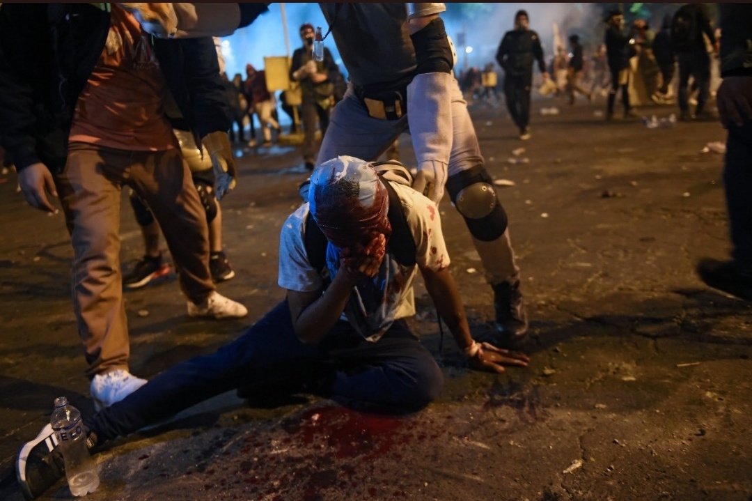 soffLL's tweet photo. Esta es la realidad que se vive en mi país, lo que pasa un peruano/ peruana al salir y luchar por nuestros derechos. Esa es la realidad señores donde la corrupción esta presente y donde los protegen a ellos en lugar que a tus compatriotas.  
 #PeruLivesMatter #PoliciasAsesinos https://t.co/50QGtXw3VA