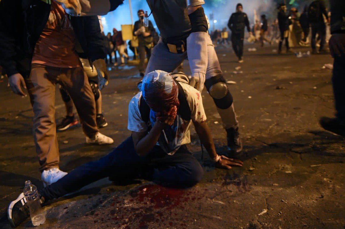 manoban397's tweet photo. Esto es irreal. Es una masacre.

#MerinoDictador
#MerinoJamasSeraMiPresidente https://t.co/nOuOqnOigR