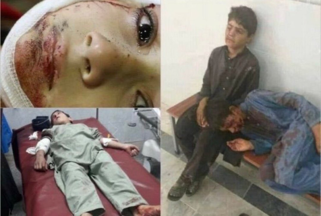 Why children? 😑 #Pakistan #StayStrongPakistan #PrayForPakistan #StopIndianAggression