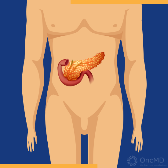 OncMD_US's tweet photo. OncMD Explains: Pancreatic Cancer

https://t.co/qXOANFuBx0

#PancreaticCancer #SecondOpinion #OncMDExplains #OncMD https://t.co/524RCHfmRc