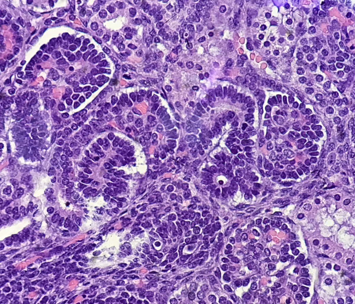 kitagawa_yukiko's tweet photo. Found unexpected beauty from my boring task.
(not unexpected for you. 😉)
#pathology No #hemepath today. https://t.co/mmdkhh27lV