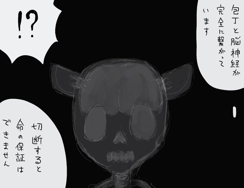 レントゲン 