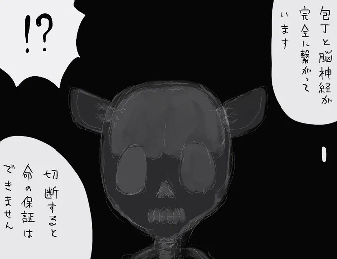 レントゲン 