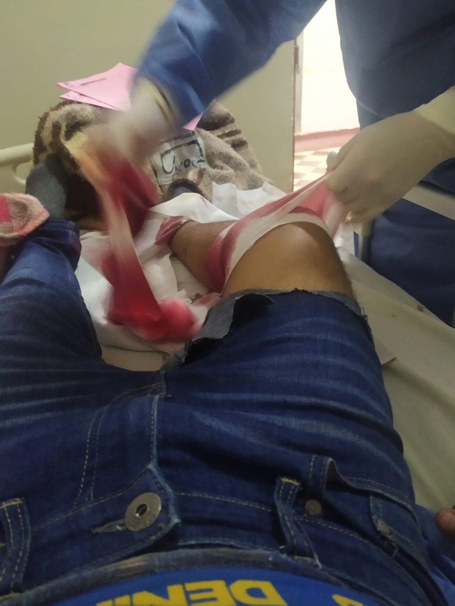 TierrActivaPeru's tweet photo. [DIFUNDIR]
Desde el Loayza, nos informan q no están permitiendo el ingreso a los familiares de Alexis q fue víctima de la represión policial. No permiten ver su historial clínico. 
Fue impactado en la rodilla derecha, se presume herida de bala(esto sería materia de investigación) https://t.co/pDFyuG63TO