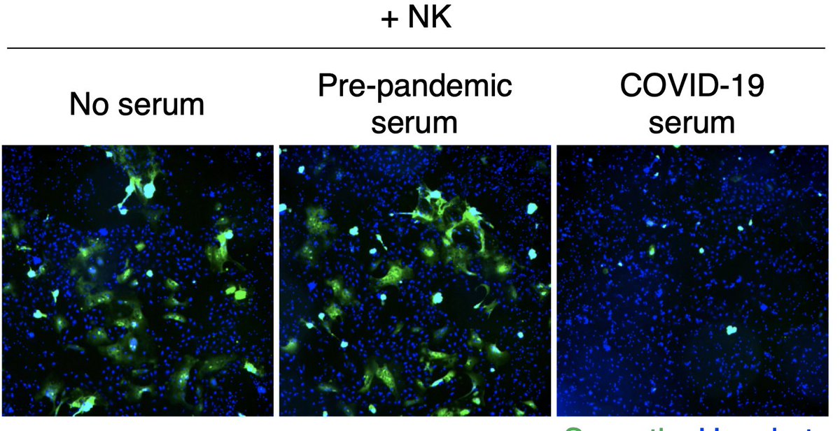 We next looked at Antibody-dependent cellular cytotoxicity (ADCC) by NK cells. On this example, you can see that infected syncytia (which are GFP) almost completely disappear in the presence of NK and COVID-19 serum ! 5/13