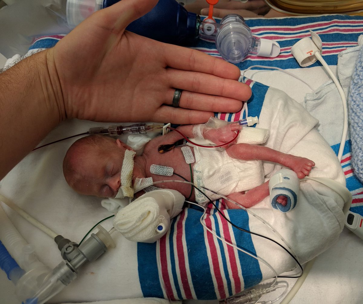 obianuju's tweet image. Can we all agree that it is a horrific evil to kill either of these babies?